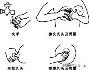 急性化脓性乳腺炎该如何预防